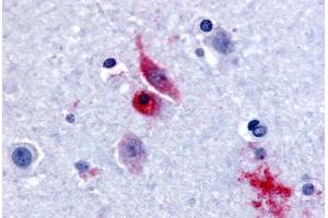 Human Brain, Caudate (formalin-fixed, paraffin-embedded) stained with GPR61 antibody ABIN213520 at 15-30 ug/ml followed by biotinylated goat anti-rabbit IgG secondary antibody ABIN481713, alkaline phosphatase-streptavidin and chromogen. (GPR61 抗体  (Extracellular Domain))