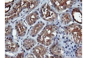 Image no. 6 for anti-V-Akt Murine Thymoma Viral Oncogene Homolog 1 (AKT1) antibody (ABIN1496557) (AKT1 抗体)