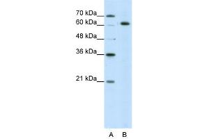 WB Suggested Anti-SNRP70 Antibody Titration:  5. (SNRNP70 抗体  (N-Term))