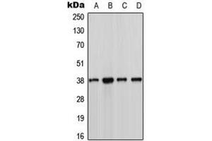 Western blot analysis of CK1 alpha expression in MCF7 (A), Jurkat (B), NIH3T3 (C), H9C2 (D) whole cell lysates. (CSNK1A1 抗体  (Center))