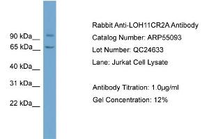 WB Suggested Anti-LOH11CR2A  Antibody Titration: 0. (VWA5A 抗体  (N-Term))