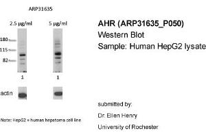 Western Blotting (WB) image for anti-Aryl Hydrocarbon Receptor (AHR) (N-Term) antibody (ABIN2777386) (Aryl Hydrocarbon Receptor 抗体  (N-Term))