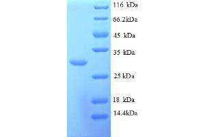 SDS-PAGE (SDS) image for Kallikrein 10 (KLK10) (AA 31-274), (partial) protein (His tag) (ABIN5712882)