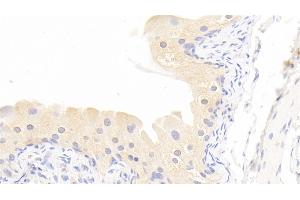 Detection of MMP13 in Rabbit Bladder Tissue using Polyclonal Antibody to Matrix Metalloproteinase 13 (MMP13) (MMP13 抗体  (AA 70-245))