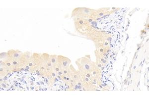 Detection of MMP13 in Rabbit Bladder Tissue using Polyclonal Antibody to Matrix Metalloproteinase 13 (MMP13)