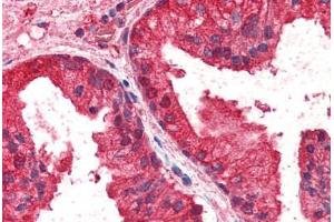 Human Prostate (formalin-fixed, paraffin-embedded) stained with CREB3L4 antibody ABIN337002 at 2. (CREB3L4 抗体  (AA 382-395))