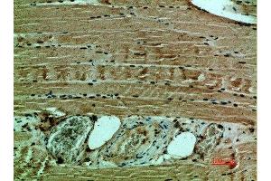 Immunohistochemical analysis of paraffin-embedded human-muscle, antibody was diluted at 1:200 (COL12A1 抗体  (AA 1268-1341))