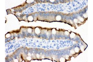 Anti- Villin Picoband antibody,IHC(P) IHC(P): Rat Intestine Tissue (Villin 1 抗体  (C-Term))