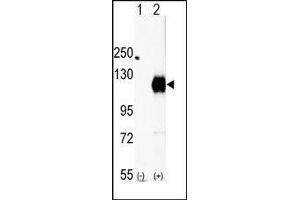 Western blot analysis of EphA2 (arrow) using rabbit polyclonal EphA2 Antibody (EPH Receptor A2 抗体  (C-Term))