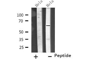Western blot analysis of extracts from Hela cells, using CP26C antibody. (CYP26C1 抗体  (Internal Region))