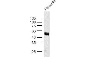 Mouse placenta lysates probed with Akt1/3 Polyclonal Antibody, unconjugated  at 1:300 overnight at 4°C followed by a conjugated secondary antibody at 1:10000 for 90 minutes at 37°C. (AKT1/3 (AA 401-479) 抗体)