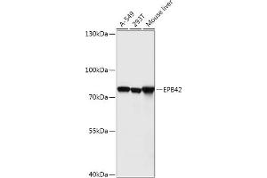 Western blot analysis of extracts of various cell lines, using EPB42 antibody (ABIN7267007) at 1:1000 dilution. (EPB42 抗体  (AA 10-240))