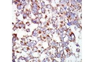 Immunohistochemistry (IHC) image for anti-Nuclear Receptor Subfamily 2, Group C, Member 2 (NR2C2) (AA 574-606) antibody (ABIN3032060)