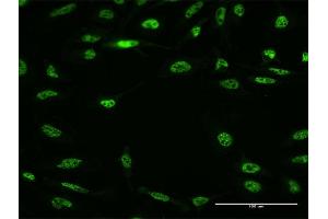 Immunofluorescence of monoclonal antibody to RBM5 on HeLa cell. (RBM5 抗体  (AA 75-184))
