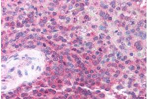 Human Spleen (formalin-fixed, paraffin-embedded) stained with TRIM32 antibody ABIN213721 at 2. (TRIM32 抗体  (AA 549-598))
