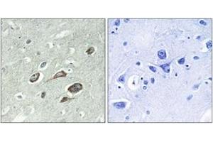 Immunohistochemistry analysis of paraffin-embedded human brain, using Calmodulin (Phospho-Thr79+Ser81) Antibody. (Calmodulin 1 抗体  (pThr79))