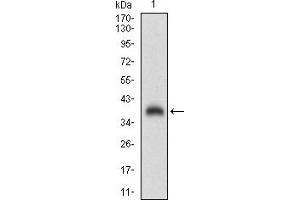 Western blot analysis using CGA mAb against human CGA (AA: 25-147) recombinant protein. (CGA 抗体  (AA 25-147))