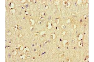 Immunohistochemistry of paraffin-embedded human brain tissue using ABIN7158541 at dilution of 1:100 (FCGR2B 抗体  (AA 12-289))