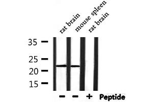 Western blot analysis of extracts from rat brain and mouse spleen, using RPL14 Antibody. (RPL14 抗体  (Internal Region))