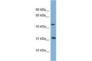 WB Suggested Anti-SERPINI2 Antibody Titration: 0. (SERPINI2 抗体  (Middle Region))