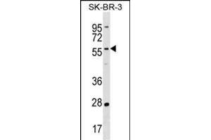 TAF6L Antibody (N-term) (ABIN1539596 and ABIN2838215) western blot analysis in SK-BR-3 cell line lysates (35 μg/lane). (TAF6L 抗体  (N-Term))