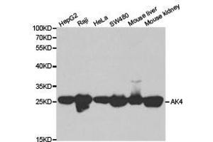 Western Blotting (WB) image for anti-Adenylate Kinase 4 (AK4) antibody (ABIN1870894) (AK4 抗体)