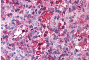 Immunohistochemistry (IHC) image for anti-Solute Carrier Family 4, Anion Exchanger, Member 1 (erythrocyte Membrane Protein Band 3, Diego Blood Group) (SLC4A1) (AA 184-233) antibody (ABIN6736430)
