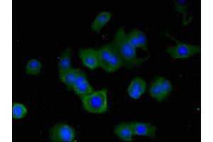Immunofluorescence (IF) image for anti-Ribosomal Protein S6 Kinase, 90kDa, Polypeptide 5 (RPS6KA5) (AA 224-367) antibody (ABIN7168188)