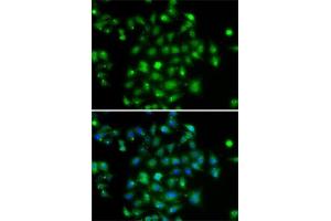 Immunofluorescence analysis of A-549 cells using DYRK2 antibody (ABIN6130879, ABIN6139897, ABIN6139898 and ABIN6222785). (DYRK2 抗体  (AA 429-528))
