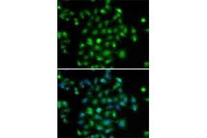 Immunofluorescence analysis of A-549 cells using DYRK2 antibody (ABIN6130879, ABIN6139897, ABIN6139898 and ABIN6222785). (DYRK2 抗体  (AA 429-528))