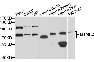 Western blot analysis of extracts of various cells, using MTMR2 antibody. (MTMR2 抗体)
