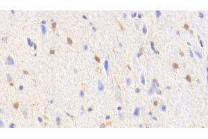 Detection of GS in Human Cerebellum Tissue using Polyclonal Antibody to Glutamine synthetase (GS) (GLN1 抗体  (AA 1-373))