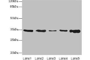Western blot All lanes: UCP3 antibody at 0. (UCP3 抗体  (AA 33-76))