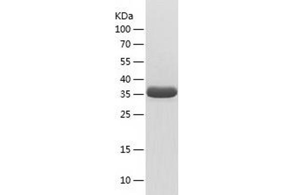 PHOX2B Protein (AA 171-314) (His-IF2DI Tag)