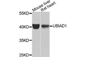 Western blot analysis of extracts of mouse liver and rat heart tissues, using UBIAD1 antibody. (UBIAD1 抗体)