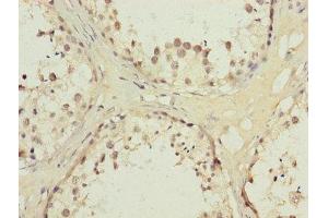 Immunohistochemistry of paraffin-embedded human testis tissue using ABIN7142330 at dilution of 1:100 (AKR1D1 抗体  (AA 1-200))