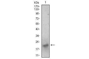 Western blot analysis using BDNF mouse mAb against SK-N-SH (1) cell lysate. (BDNF 抗体  (AA 19-248))