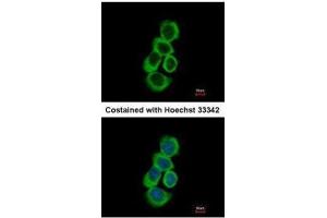 ICC/IF Image Immunofluorescence analysis of methanol-fixed A431, using BHMT, antibody at 1:500 dilution. (BHMT 抗体)