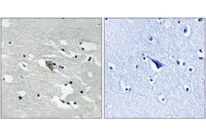 Immunohistochemistry analysis of paraffin-embedded human brain, using VEGFR1 (Phospho-Tyr1048) Antibody.