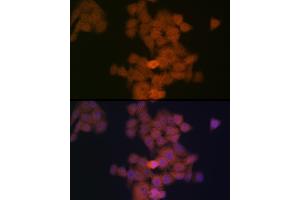 Immunofluorescence analysis of HeLa cells using PFDN5 Rabbit mAb (ABIN1682853, ABIN3018535, ABIN3018536 and ABIN7101624) at dilution of 1:100 (40x lens). (PFDN5 抗体)