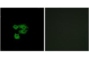Immunofluorescence analysis of A549 cells, using LY6E Antibody. (LY6E 抗体  (AA 17-66))