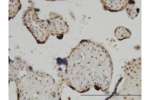 Immunoperoxidase of monoclonal antibody to ZIC4 on formalin-fixed paraffin-embedded human placenta. (ZIC4 抗体  (AA 249-319))