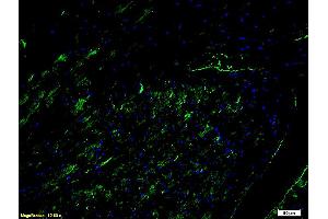 Formalin-fixed and paraffin embedded mouse heart tissue labeled with Anti-CD54 ICAM-1 Polyclonal Antibody, unconjugated (ABIN670806) at 1: 200,followed by incubation with conjugated secondary antibody (Goat Anti-Rabbit IgG, PE conjugated at 1: 200 for 40 minutes at 37°C). (ICAM1 抗体  (AA 201-300))