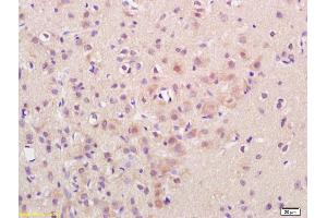 Immunohistochemistry (IHC) image for anti-Calcium/calmodulin-Dependent Protein Kinase II beta (CAMK2B) (AA 101-200) antibody (ABIN1386359)