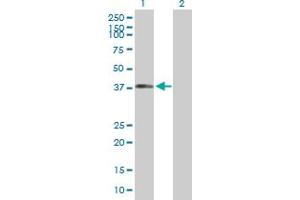 Western Blot analysis of DYNC1H1 expression in transfected 293T cell line by DYNC1H1 MaxPab polyclonal antibody. (DYNC1H1 抗体  (AA 1-197))