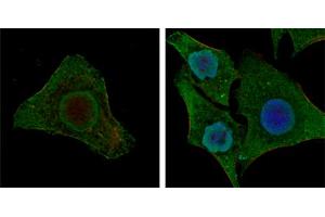 Confocal immunofluorescence analysis of MCF-7 (left) and HepG2 (right) cells using BRAF mouse mAb (green). (BRAF 抗体)
