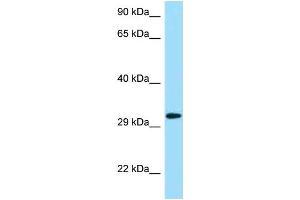 Western Blotting (WB) image for anti-Killer Cell Lectin-Like Receptor Subfamily C, Member 1 (KLRC1) (N-Term) antibody (ABIN2788755) (KLRC1 抗体  (N-Term))
