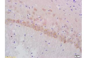 Formalin-fixed and paraffin embedded rat brain labeled with Anti-Gamma-Adaptin Polyclonal Antibody, Unconjugated  at 1:200 followed by conjugation to the secondary antibody and DAB staining (gamma 1 Adaptin 抗体  (AA 721-822))