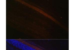 Immunofluorescence analysis of Rat retina using GRK1 Polyclonal Antibody at dilution of 1:100 (40x lens).