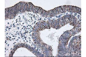 Immunohistochemistry (IHC) image for anti-Dihydrolipoamide Dehydrogenase (DLD) antibody (ABIN1497846) (DLD 抗体)